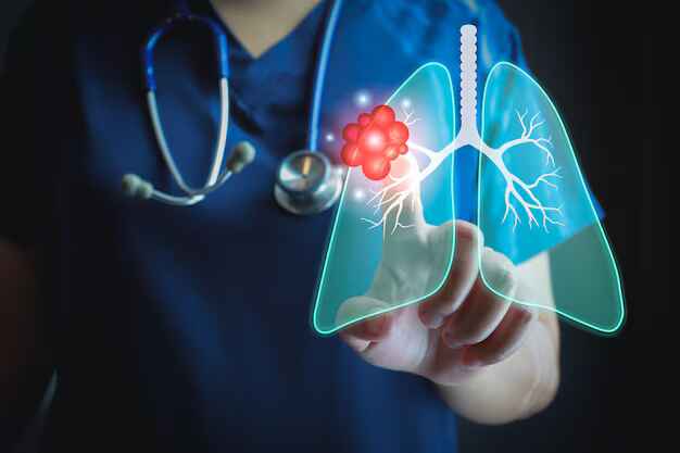 International Conference on Advanced Pulmonology & Lung Health